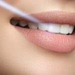 Advanced Oral Health Care with Laser Technology 10 Perfect smile with white teeth