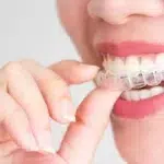 How Invisalign Can Help Prevent Future Dental Problems 8 A smiling woman holding invisalign