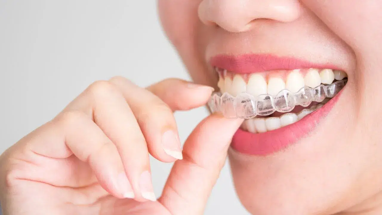 A smiling woman holding invisalign