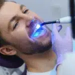 Signs Your Composite Filling Needs Replacement 3 Closeup portrait patient in dental office